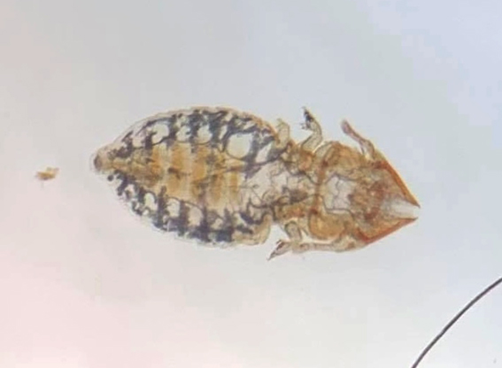 A photograph of a biting louse found at Park House Vets Stafford.