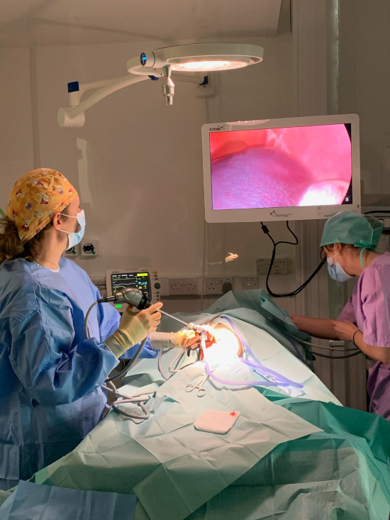 A laparoscopy procedure
